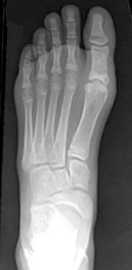 Pediatrics Board Review 2007: High-Yield MCQs (Set 4) - Figure 5