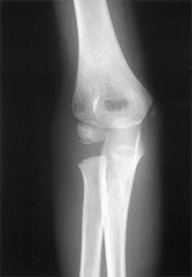 Pediatrics Board Review 2007: High-Yield MCQs (Set 4) - Figure 9