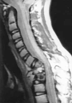 Pediatrics 2026 MCQs: Board Review Questions & Answers (Part 1) - Figure 10