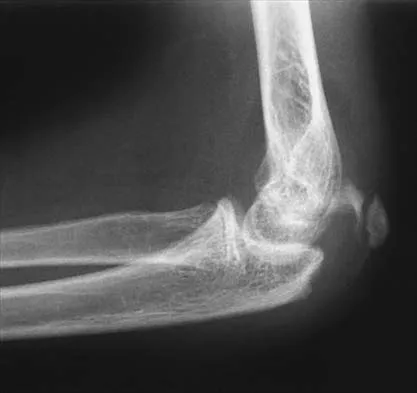 Pediatrics 2026 MCQs: Board Review Questions & Answers (Part 1) - Figure 117