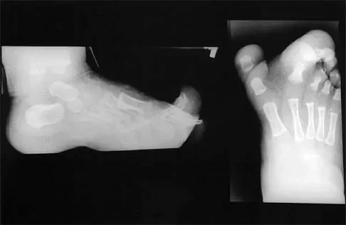 Pediatrics 2026 MCQs: Board Review Questions & Answers (Part 1) - Figure 139