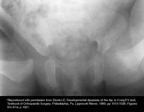 Pediatrics 2026 MCQs: Board Review Questions & Answers (Part 1) - Figure 169