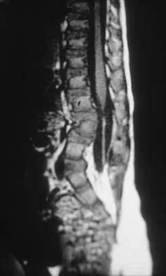 Pediatrics 2026 MCQs: Board Review Questions & Answers (Part 1) - Figure 179