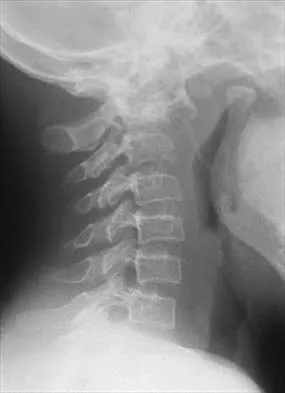 Pediatrics 2026 MCQs: Board Review Questions & Answers (Part 1) - Figure 18