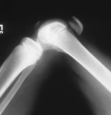 Pediatrics 2026 MCQs: Board Review Questions & Answers (Part 1) - Figure 209