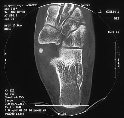 Pediatrics 2026 MCQs: Board Review Questions & Answers (Part 1) - Figure 229