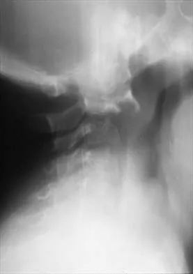 Pediatrics 2026 MCQs: Board Review Questions & Answers (Part 1) - Figure 241