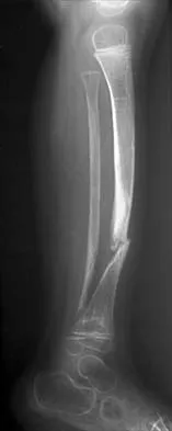 Pediatrics 2026 MCQs: Board Review Questions & Answers (Part 1) - Figure 251