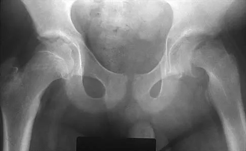 Pediatrics 2026 MCQs: Board Review Questions & Answers (Part 1) - Figure 271