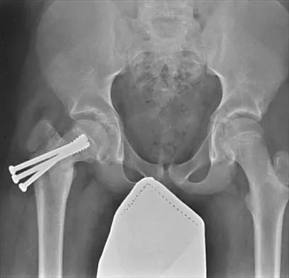 Pediatrics 2026 MCQs: Board Review Questions & Answers (Part 1) - Figure 285