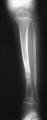 Pediatrics 2026 MCQs: Board Review Questions & Answers (Part 1) - Figure 295