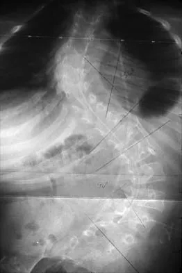 Pediatrics 2026 MCQs: Board Review Questions & Answers (Part 1) - Figure 44