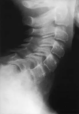 Pediatrics 2026 MCQs: Board Review Questions & Answers (Part 1) - Figure 8