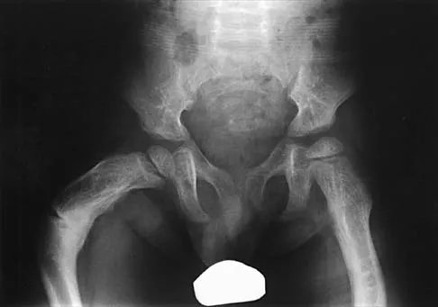 Pediatrics 2026 MCQs: Board Review Questions & Answers (Part 1) - Figure 86