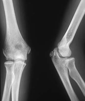 Pediatrics 2026 MCQs: Board Review Questions & Answers (Part 2) - Figure 17