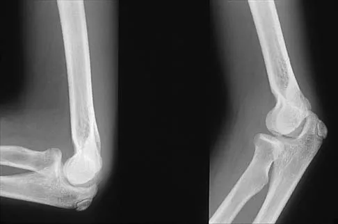 Pediatrics 2026 MCQs: Board Review Questions & Answers (Part 2) - Figure 19