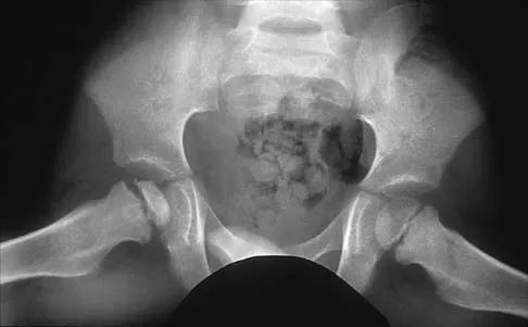 Pediatrics 2026 MCQs: Board Review Questions & Answers (Part 2) - Figure 25