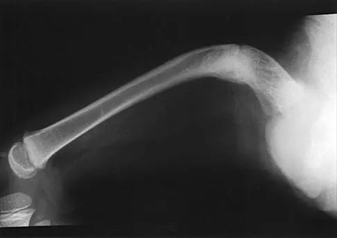 Pediatrics 2026 MCQs: Board Review Questions & Answers (Part 2) - Figure 47