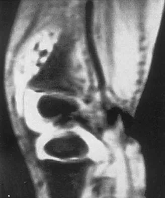 Pediatrics 2026 MCQs: Board Review Questions & Answers (Part 2) - Figure 53