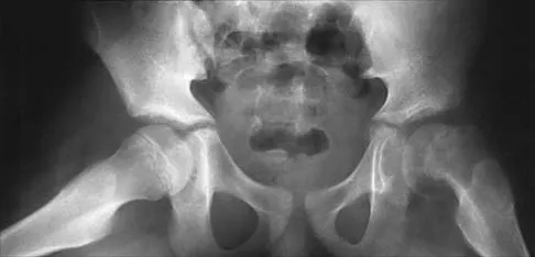 Pediatrics 2026 MCQs: Board Review Questions & Answers (Part 2) - Figure 63