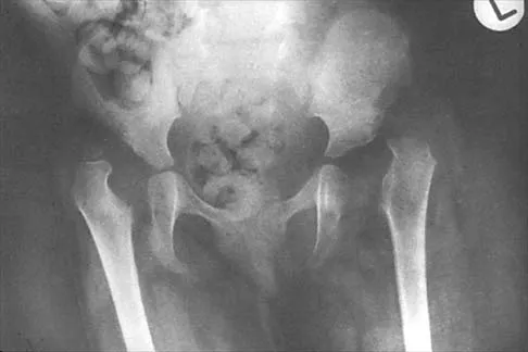 Pediatrics 2026 MCQs: Board Review Questions & Answers (Part 2) - Figure 81