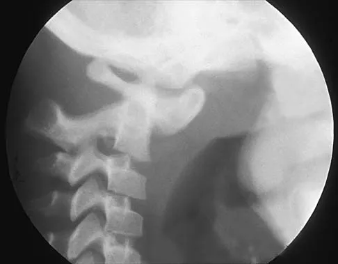 Pediatrics 2026 MCQs: Board Review Questions & Answers (Part 2) - Figure 9