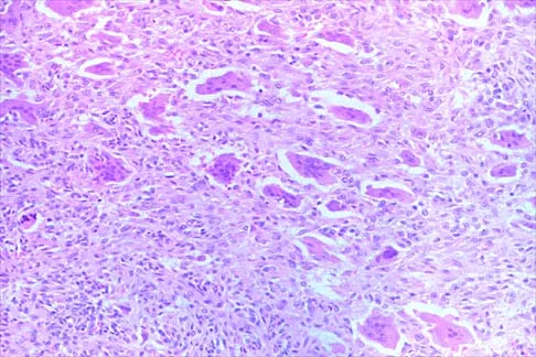 Pediatrics 2026 MCQs: Board Review Questions & Answers (Part 3) - Figure 15