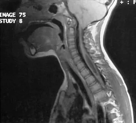 Pediatrics 2026 MCQs: Board Review Questions & Answers (Part 3) - Figure 23