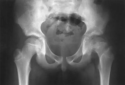 Pediatrics 2026 MCQs: Board Review Questions & Answers (Part 3) - Figure 61