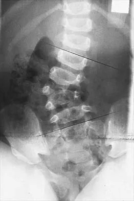 Pediatrics 2026 MCQs: Board Review Questions & Answers (Part 3) - Figure 83