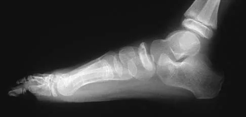 Pediatrics 2026 MCQs: Board Review Questions & Answers (Part 4) - Figure 19