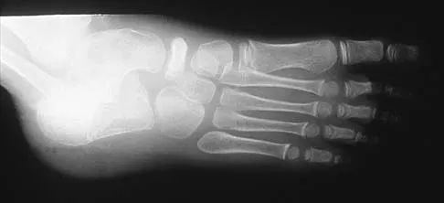 Pediatrics 2026 MCQs: Board Review Questions & Answers (Part 4) - Figure 21