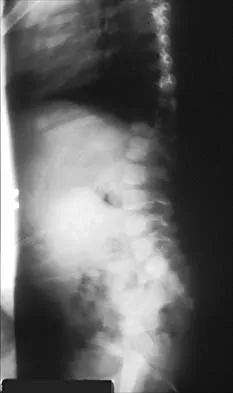 Pediatrics 2026 MCQs: Board Review Questions & Answers (Part 4) - Figure 37