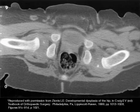 Pediatrics 2026 MCQs: Board Review Questions & Answers (Part 4) - Figure 43