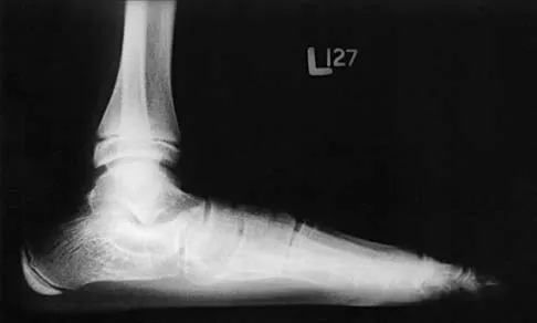 Pediatrics 2026 MCQs: Board Review Questions & Answers (Part 4) - Figure 7