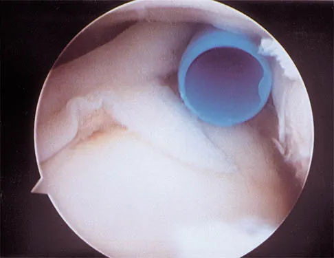 Orthopedic Board Review MCQs (2026 Edition) - Part 5