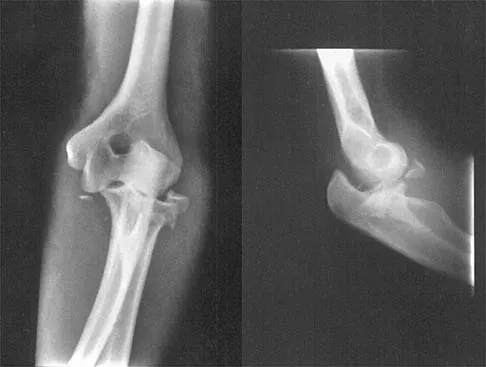 Shoulder 2000 Practice Questions: Set 1 (Solved) - Figure 3