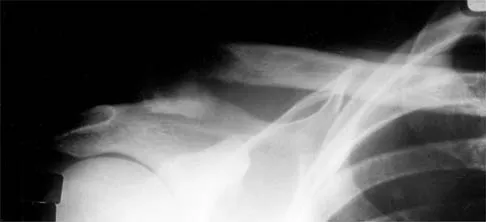 Shoulder 2000 Practice Questions: Set 1 (Solved) - Figure 7