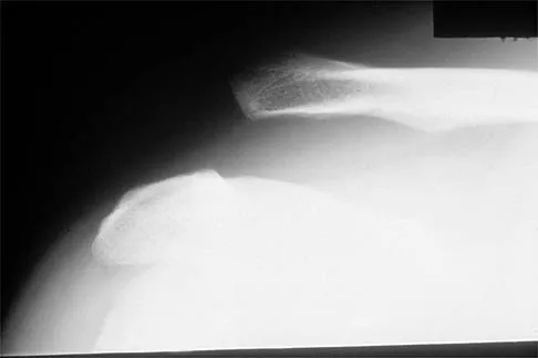 Shoulder 2002 Practice Questions: Set 1 (Solved) - Figure 21