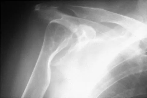 Shoulder 2002 Practice Questions: Set 1 (Solved) - Figure 30