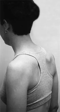 Shoulder 2002 Practice Questions: Set 1 (Solved) - Figure 31