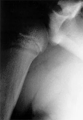 Shoulder 2002 Practice Questions: Set 1 (Solved) - Figure 6