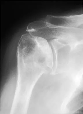 Shoulder 2002 Practice Questions: Set 1 (Solved) - Figure 9