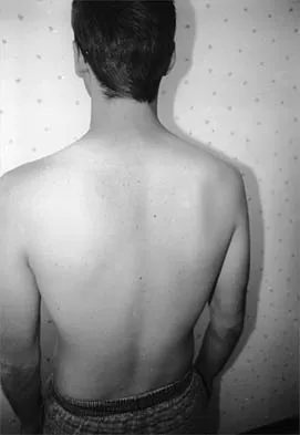 Shoulder Board Review 2002: High-Yield MCQs (Set 2) - Figure 17