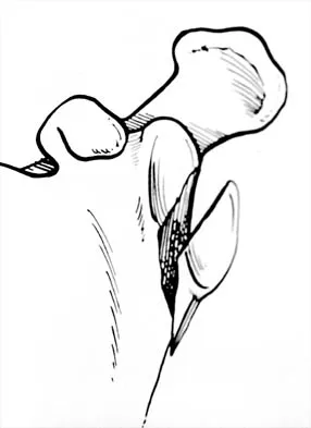 Shoulder Board Review 2002: High-Yield MCQs (Set 2) - Figure 29