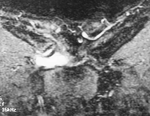 Shoulder Board Review 2002: High-Yield MCQs (Set 2) - Figure 31