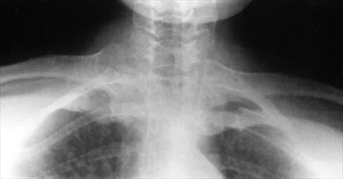 Shoulder Board Review 2002: High-Yield MCQs (Set 2) - Figure 32