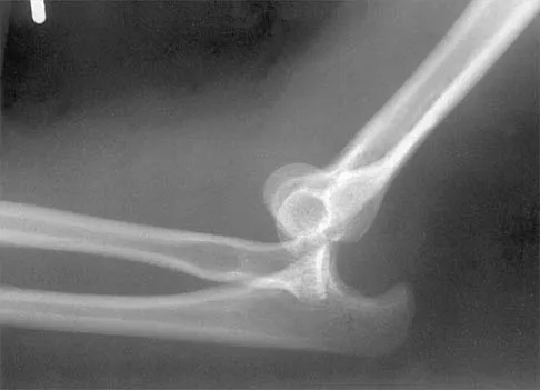 Shoulder 2002 Practice Questions: Set 3 (Solved) - Figure 18