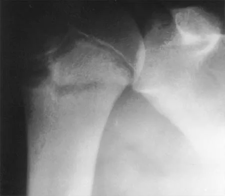 Shoulder 2002 Practice Questions: Set 3 (Solved) - Figure 7