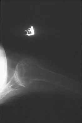 Shoulder Board Review 2002: High-Yield MCQs (Set 4) - Figure 12